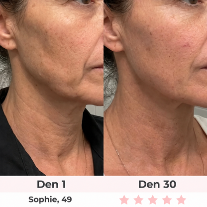 Glow Lab 7-in-1 LED Facial Sculptor