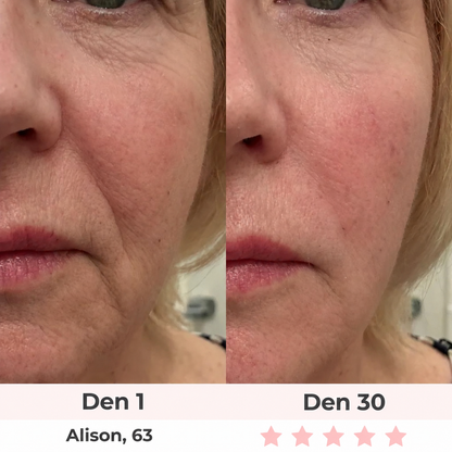 Glow Lab 7-in-1 LED Facial Sculptor