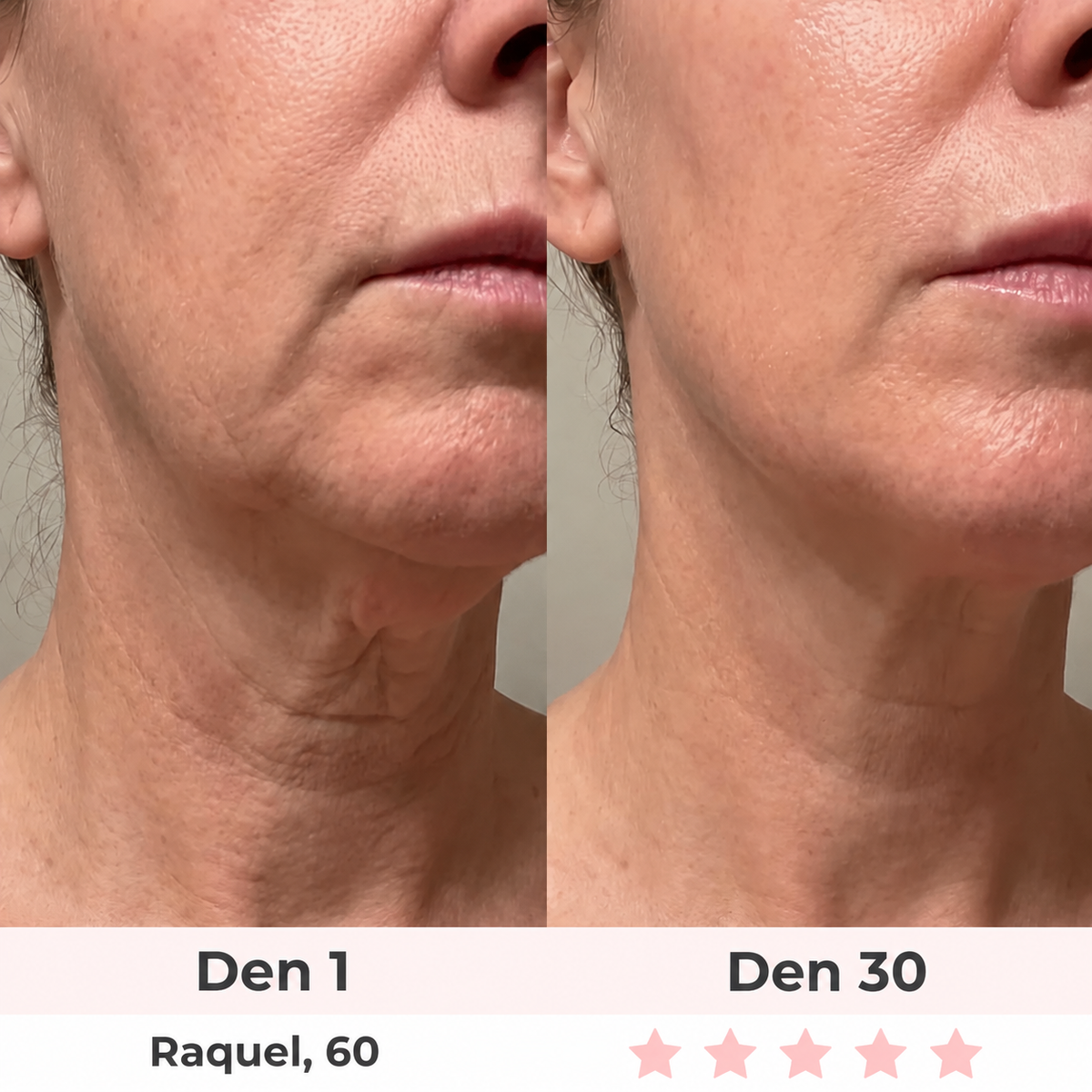 Glow Lab 7-in-1 LED Facial Sculptor