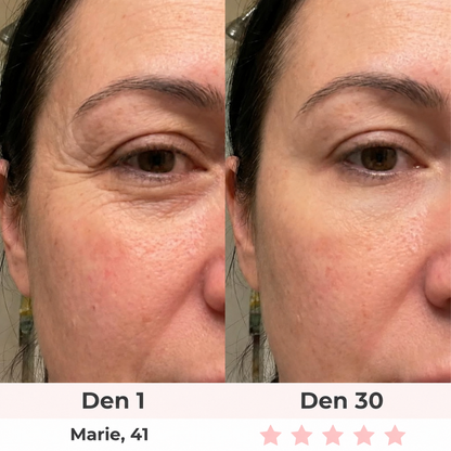 Glow Lab 7-in-1 LED Facial Sculptor